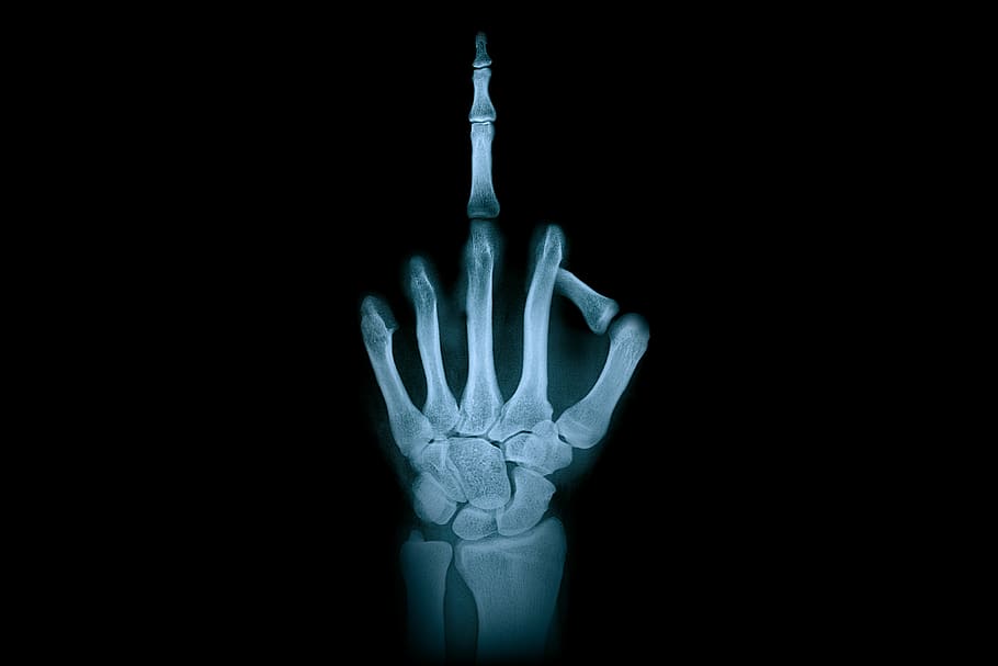 A middle finger in skeleton form - Un dito medio scheletrico
